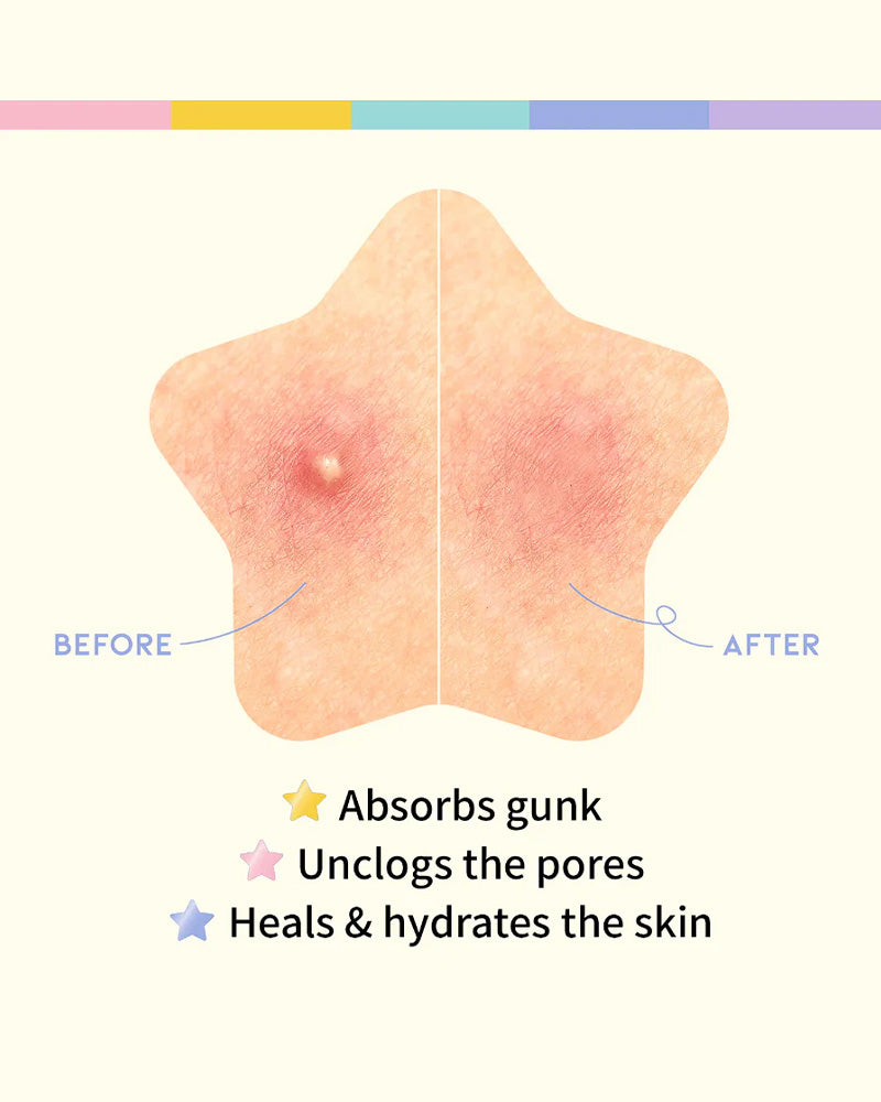 OOTD Hydrocolloid Blemish Care Star Spot Patch